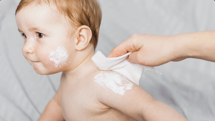 cara mengatasi biang keringat bayi di musim kemarau